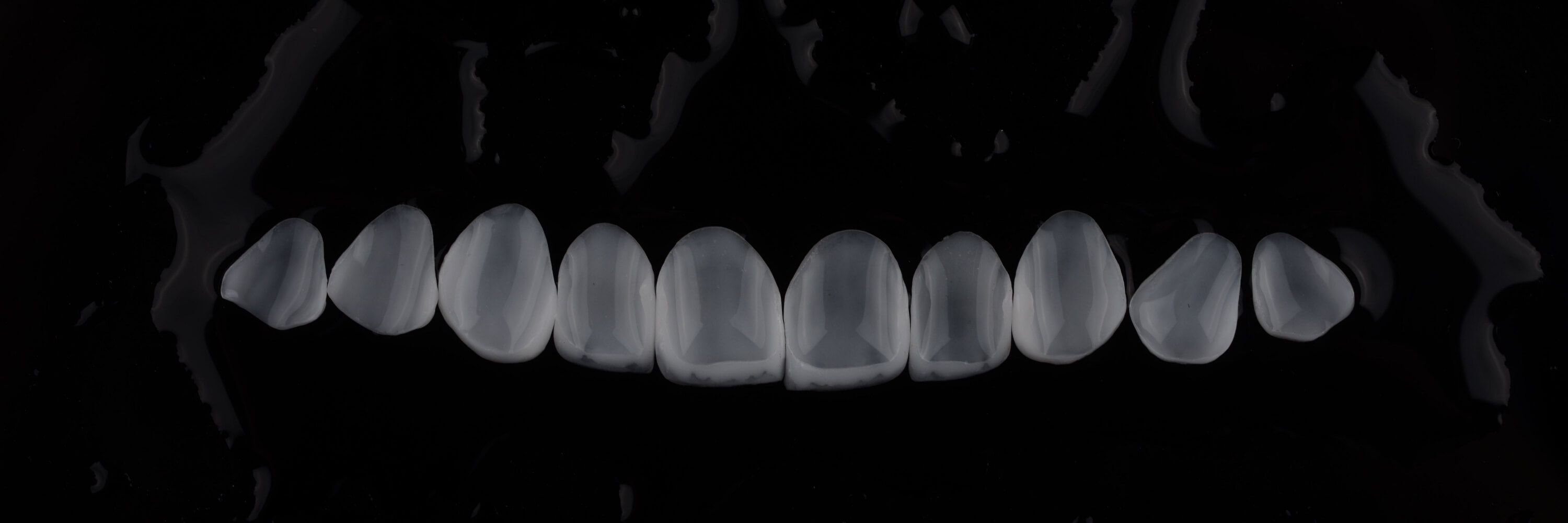 керамические виниры перед установкой на зубы