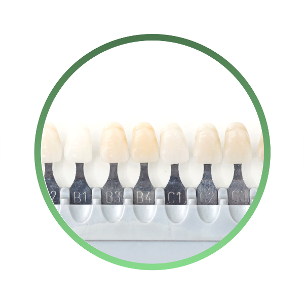 оптимизация цвета коронки и виниров на зубы входит в стоимость протезирования зубов под ключ методом цифровой стоматологии