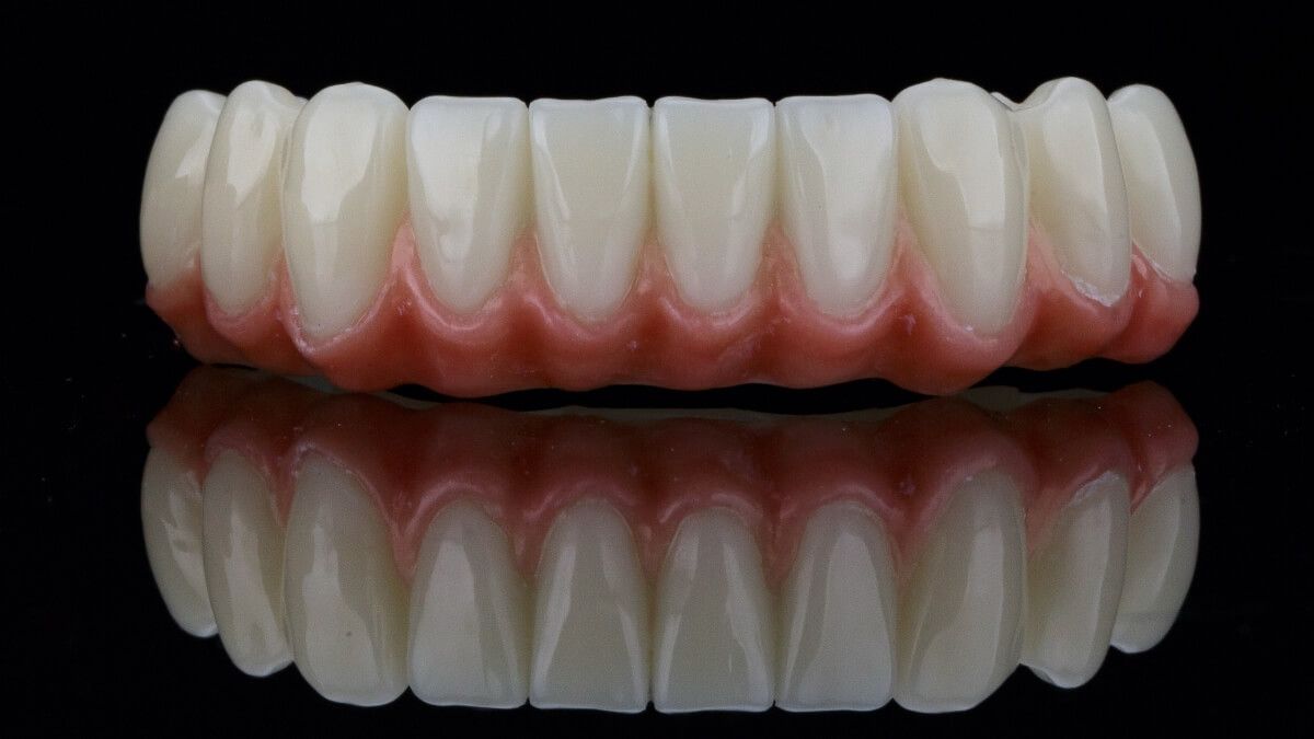 Зубной протез нижней челюсти All-on-4 | Все-на-4