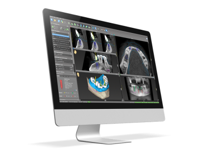 компьютер с томографией зубов для планирования протезирования зубов