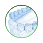 сканирование положения в процессе протезирования зубов с опорой на дентальные имплантаты