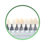 определение оптимального цвета коронки  входит в стоимость имплантации переднего зуба под ключ