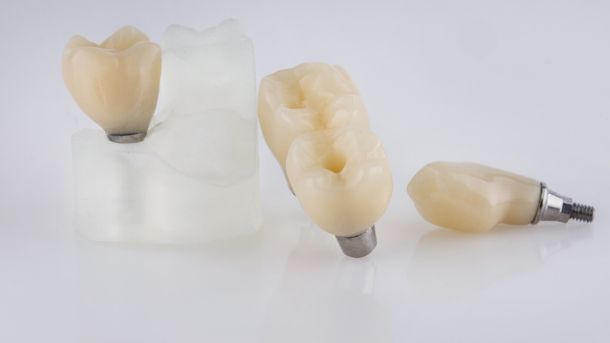 коронки и мосты из циркония для протезирования зубов перед установкой пациенту