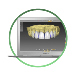 проектирование оптимально формы коронки  входит в стоимость имплантации переднего зуба под ключ