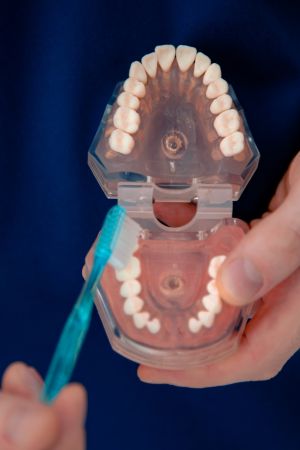 модель зубов в руках стоматолога