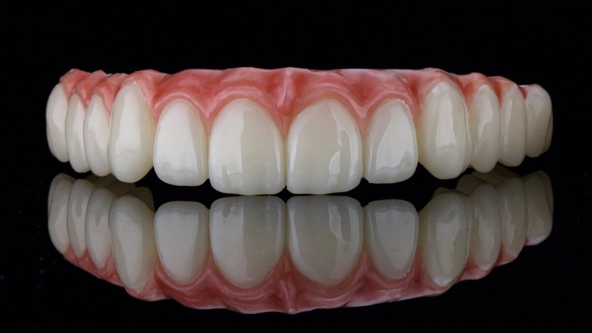Зубной протез верхней челюсти All-on-4 | Все-на-4